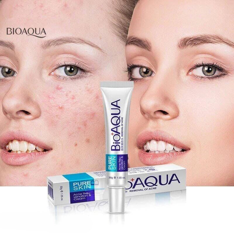 Acne Scar Removal Rejuvenation Cream